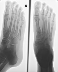 Jou Ma Se Seun Se Voet!